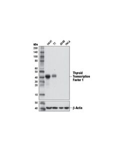 Cell Signaling Thyroid Transcription Factor 1 (Ttf-1) (D2e8) Rabbit mAb (BSA And Azide Free)