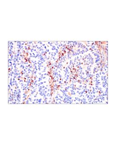 Cell Signaling Pi3 Kinase P110 Delta (E2t2n) Rabbit mAb
