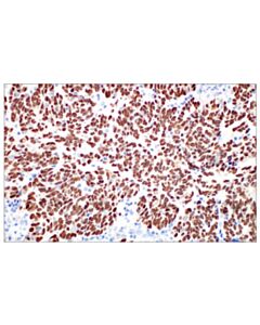 Cell Signaling Mage-C2/Ct10 (E7b8d) Xp ® Rabbit mAb