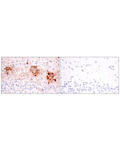 Cell Signaling Phospho-Tau (Thr205) (E3e3b) Mouse mAb