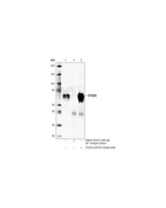 Cell Signaling Otud5 (D8y2u) Rabbit mAb