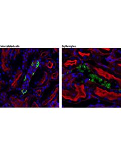 Cell Signaling Ae1/Slc4a1 (D3x1r) Rabbit mAb (If Formulated; Rodent Specific)
