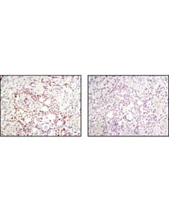 Cell Signaling Msh2 (D24b5) Xp Rabbit mAb