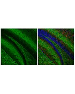 Cell Signaling SNAP25 (F1A9G) Mouse mAb 20 uL