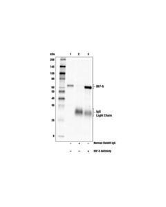 Cell Signaling Irf-5 Antibody
