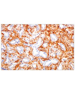 Cell Signaling Periostin (E5f2s) Rabbit mAb