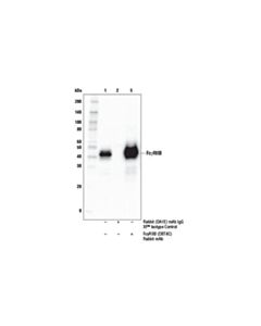 Cell Signaling Fcgammariib (D8t4c) Rabbit mAb