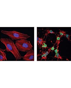 Cell Signaling Cleaved Lamin A (Small Subunit) Antibody