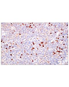 Cell Signaling Serpinb1 (E4w7b) Rabbit mAb