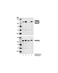 Cell Signaling Phospho-Pkd/Pkcmu (Ser916) Antibody