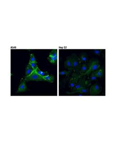 Cell Signaling Iqgap1 (D8k4x) Xp Rabbit mAb