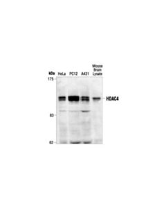 Cell Signaling Histone Deacetylase 4 (Hdac4) Antibody
