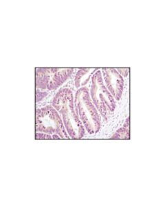 Cell Signaling Axin1 (C95h11) Rabbit mAb