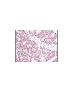 Cell Signaling Axin1 (C76h11) Rabbit mAb