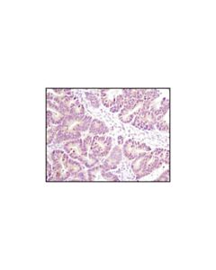 Cell Signaling Axin1 (C76h11) Rabbit mAb