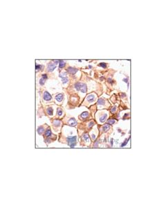 Cell Signaling Phospho-Src (Tyr527) Antibody