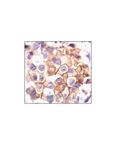 Cell Signaling Phospho-Src (Tyr527) Antibody