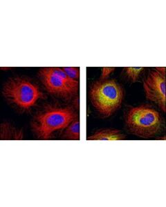 Cell Signaling Beta-Tubulin (9f3) Rabbit mAb (Alexa Fluor 555 Conjugate)