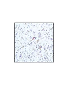 Cell Signaling Beta-Tubulin (9f3) Rabbit mAb