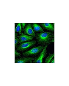 Cell Signaling Beta-Tubulin (9f3) Rabbit mAb