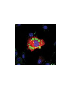 Cell Signaling Atgl Antibody