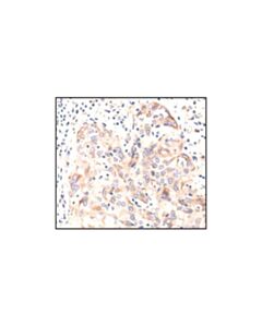 Cell Signaling Beta-Tubulin Antibody