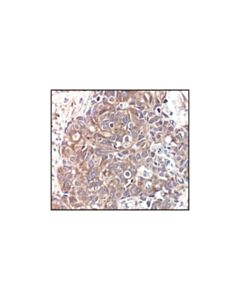 Cell Signaling Alpha/Beta-Tubulin Antibody