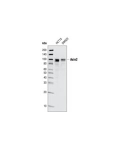 Cell Signaling Axin2 (76g6) Rabbit mAb