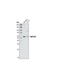 Cell Signaling Mbtps2 Antibody