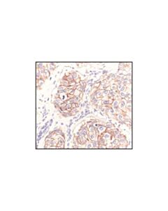 Cell Signaling Her2/Erbb2 (29d8) Rabbit mAb