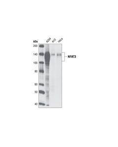 Cell Signaling Nfat3 (23e6) Rabbit mAb