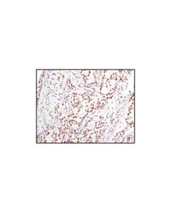 Cell Signaling Lsd1 (C69g12) Rabbit mAb