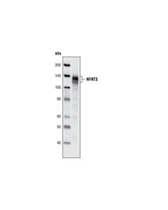 Cell Signaling Nfat3 (31g6) Rabbit mAb