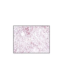 Cell Signaling Tcf1/Tcf7 (C63d9) Rabbit mAb