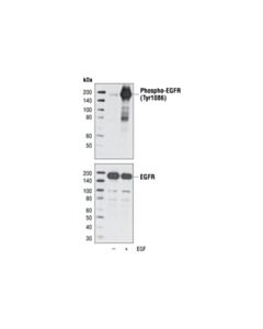 Cell Signaling Phospho-Egf Receptor (Tyr1086) Antibody