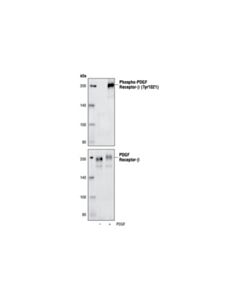 Cell Signaling Phospho-Pdgf Receptor Beta (Tyr1021) (6f10) Rabbit mAb