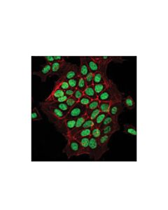 Cell Signaling Lef1 (C12a5) Rabbit mAb