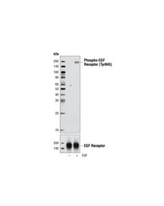 Cell Signaling Phospho-Egf Receptor (Tyr845) Antibody