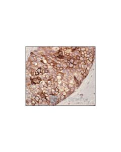 Cell Signaling Phospho-Egf Receptor (Tyr1068) Antibody