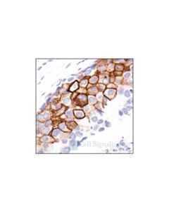 Cell Signaling Phospho-Egf Receptor (Tyr992) Antibody