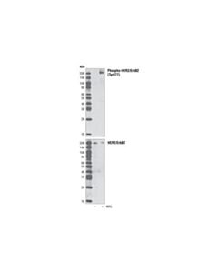 Cell Signaling Phospho-Her2/Erbb2 (Tyr877) Antibody