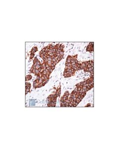 Cell Signaling Her2/Erbb2 Antibody