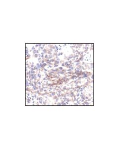 Cell Signaling Phospho-Her2/Erbb2 (Tyr1221/1222) (6b12) Rabbit mAb