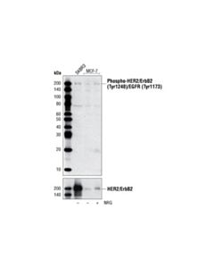 Cell Signaling Phospho-Her2/Erbb2 (Tyr1248)/Egfr (Tyr1173) Antibody