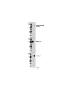 Cell Signaling Phospho-Her2/Erbb2 (Tyr1248) Antibody