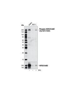 Cell Signaling Phospho-Her2/Erbb2 (Tyr1221/1222) Antibody