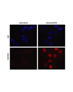 Cell Signaling Fosb Antibody