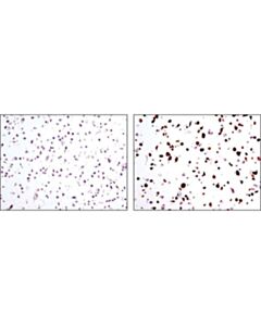 Cell Signaling Myc-Tag (9b11) Mouse mAb