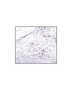 Cell Signaling Cathepsin D Antibody