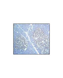 Cell Signaling Drak2 (33d7) Rabbit mAb